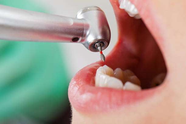Best Emergency Dental Care for Abscessed Tooth in Hickory Creek, TX